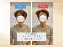 エモア メディカル整体院 恵比寿院(Emoa)/【20代男性】小顔矯正