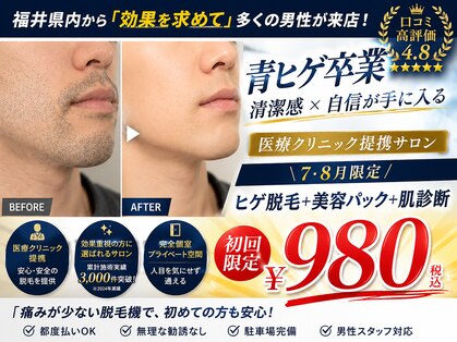 ファスモ(FASMO)の写真