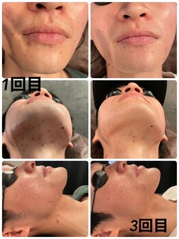 サクロス(Sacloth)/10代後半学生さんにも人気です○