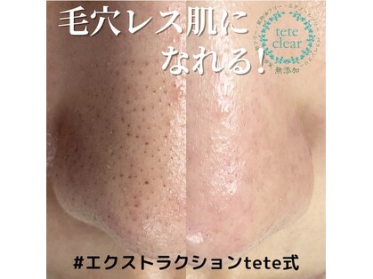 ミラーヴ(MERAVE)の写真