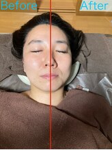 ズミレガーロ(Zumiregalo)/頭皮ケアは、リフトアップ可能