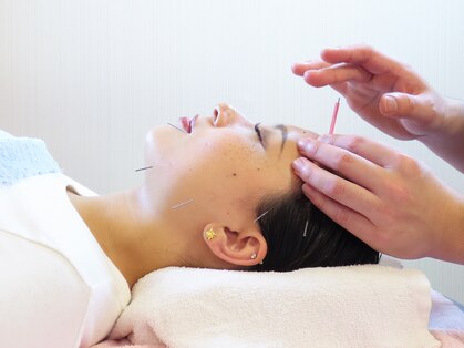 坂下通りべんてん鍼灸 整骨院の写真