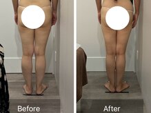 トータルビューティ リライフ(Total beauty Relife)/チノザメソッドでデトックス