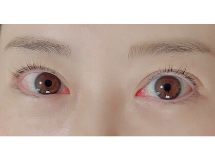 ルポ(RUPO)の写真