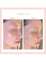 ヨウン 大阪心斎橋(yeoun)/ララピール/ララピール大阪