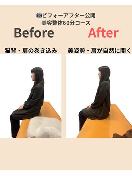 アルク美容整体院(ARUKU美容整体院)/☆猫背・巻き肩が整い美姿勢に☆