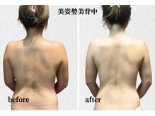 オトサロン(Otosalon)の雰囲気（痩身効果だけでなく姿勢改善にも◎巻き方・猫背でお悩みの方に★）