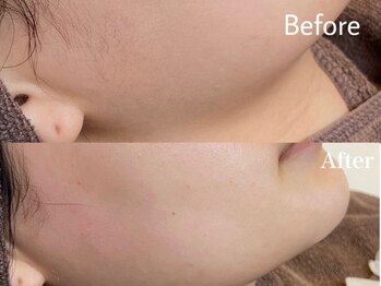 まつげエクステ専門店 ベル(Belle)/フェイスワックス