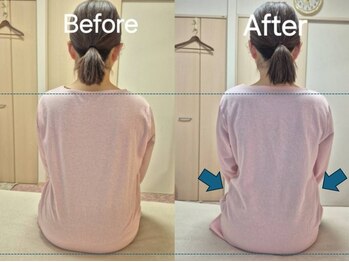 スノー シャイン(SNOW SHINE)/【Before→After】