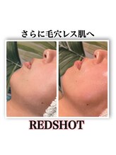ルアナライフ(Luana Life)/30代・毛穴もたるみも小ジワも