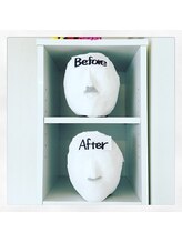 トータルビューティーサロン キララ(KIRARA)/小顔コルギ　ビフォーアフター