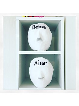 トータルビューティーサロン キララ(KIRARA)/小顔コルギ ビフォーアフター