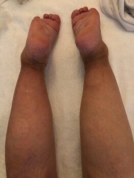 中国整体 らくらく堂/遠赤外線リンパケア脚セラピー