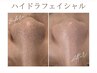 【人気NO.1】陶器肌毛穴ケアセットハイドラ＋光フォト＋強炭酸パック 90分
