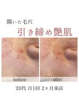 アネラ(Anela)/汚れをしっかり取らないと…