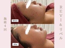 ルア(LuA.)/艶々お肌♪