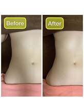 トータルケアミミ(mimi)/ボディメイク♪