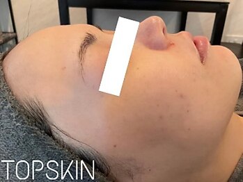 トップスキン 栄(TOPSKIN)/目指せ☆白玉ツヤ肌！