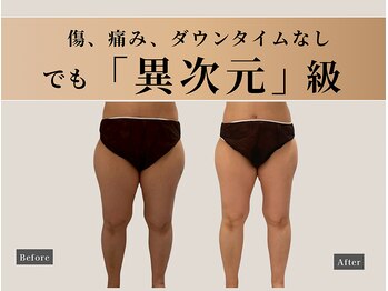 ナチュリ センター南院(NACHUL)/スリムケア