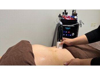 ノエ(Noe)/サイズダウン