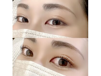 アルファ(alpha)の写真