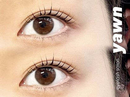 ヨウン(yawn)の写真