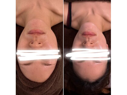 アンティス(Antis)の写真