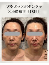 ネイルアンドアンチエイジングドゥシール(Docile)/50代女性｜たるみ・老け見え改善