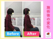 ナオル整体 川越院(NAORU整体)/猫背姿勢を撃退！【整体/矯正】