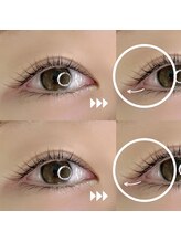 リィーユウ(ri-U)/垂れ目パーマ/メーテルロッド