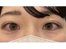 アールエム(Rm)/8月#まつげ