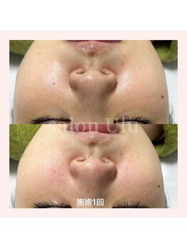 ウル(Ulu)/キレイな毛穴を維持！