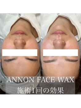 カシェット(Cachette)/フェイシャルワックス