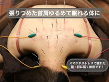 スプリング鍼灸院(Spring鍼灸院)の雰囲気（頑固な首肩こりでお悩みの方、当院の全身鍼で改善しませんか？）