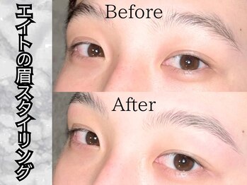 メンズ脱毛 メンズエステ エイト(8)