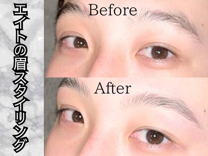 メンズ脱毛 メンズエステ エイト(8)の写真