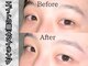 メンズ脱毛 メンズエステ エイト(8)の写真