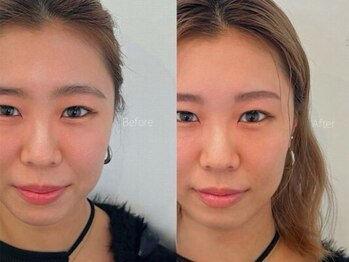 ハリウッドブロウリフトワクシー 渋谷(HOLLYWOODBROWLIFT WAXYYY.)/眉毛が顔の印象の8割を決める◎