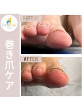 ドクターネイル爪革命 群馬両毛店/