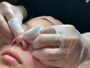 ミー(美mee)の写真/年間600人以上施術★大人女性に支持される毛穴サロン♪毛穴専門店ならではの施術で毛穴のお悩みを徹底改善!