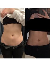 ロザブルー(ROSA BLU)/before/after