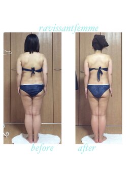 ラヴィソンファム(Ravissant femme)/痩身エステ/ビフォー＆アフター