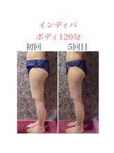 プラチナローズ(Platinum Rose)/インディバ痩身