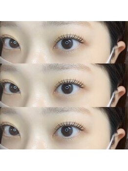 アールラッシュ(R-LASH)/ラッシュリフト