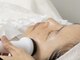 スーン(soon)の写真/【結果重視の肌質改善！】お肌のお悩みを抱えた大人女性に大人気♪今までのお肌に戻らないシミケア！