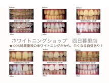 ホワイトニングショップ 西日暮里店