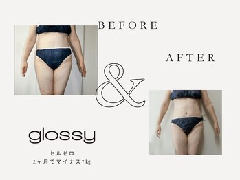 グロッシー(glossy)/【症例】セルゼロ＆痩身手技