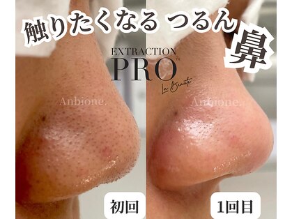 アンビワン(Anbione.)の写真