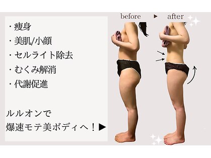 ヨサパーク ユアン(YOSA PARK yuann)の写真