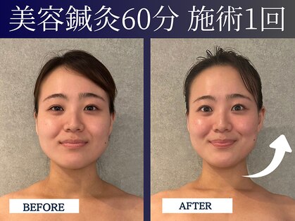 シンク(CINQ)の写真